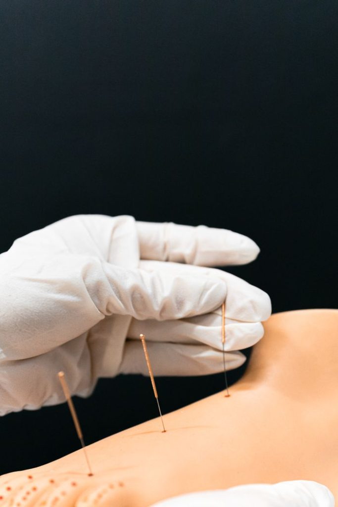 Medico specialista in agopuntura a Seregno